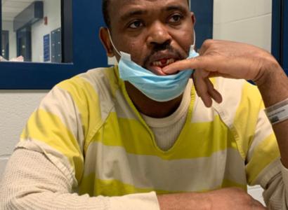 Man showing a spot in mouth where there is a gap.