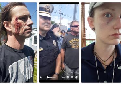 A guy with a bleeding face, cops and protestors
